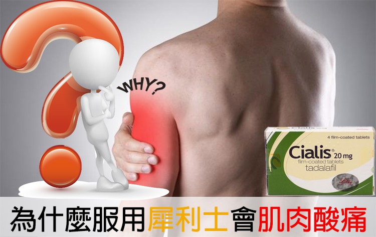 犀利士導致肌肉酸痛正常嗎？專科醫師教你正確應對