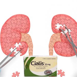 犀利士會損傷腎臟嗎？專科醫師教你護腎技巧