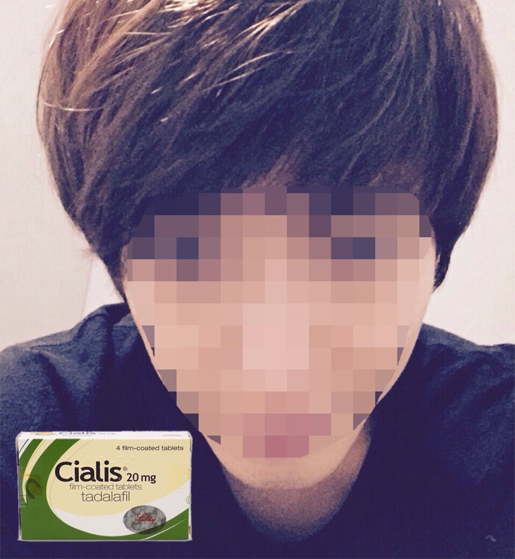 1️⃣ 陳先生:從威而鋼轉用犀利士,頭暈大幅改善 1️⃣ 陳先生:從威而鋼轉用犀利士,頭暈大幅改善